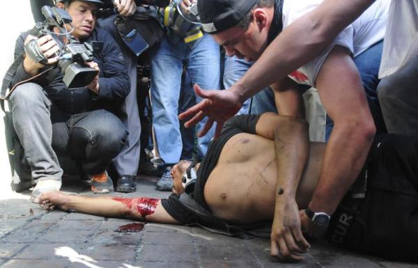 Un hombre yace en el piso luego de ser herido de bala durante una manifestación en Caracas hoy, miércoles 12 de febrero de 2014.