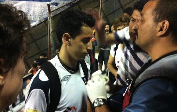 hincha deliga