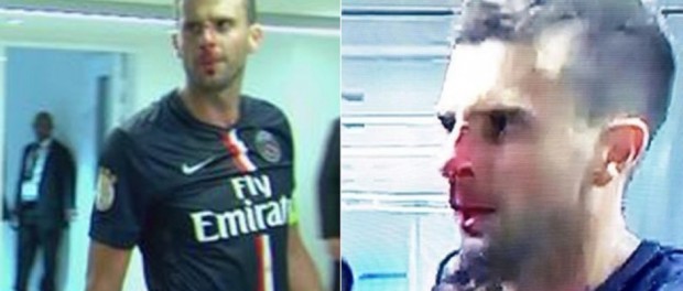 motta-cabezazo-brandao