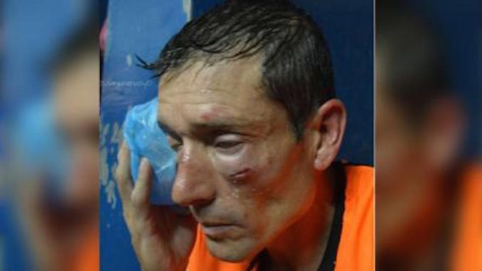 arbitro-golpeado