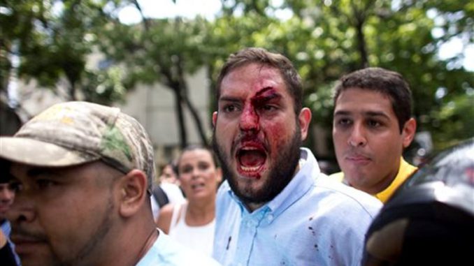 Congresista herido en el rostro Venezuela