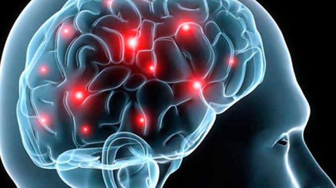 epilepsia