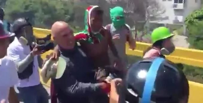 niño herido en venezuela