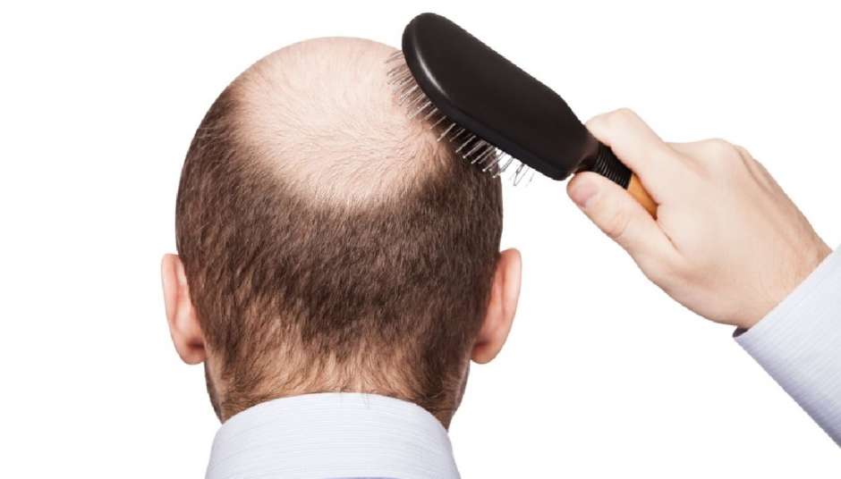 Imagem relacionada