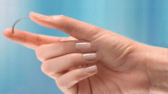 anticonceptivo Essure