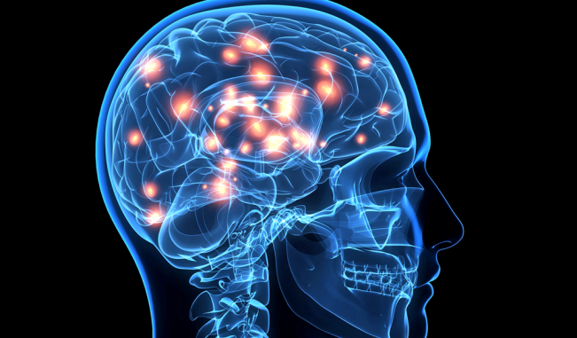 cerebro