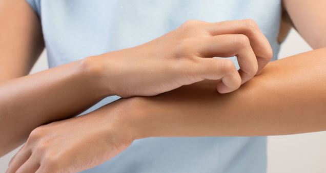 dermatitis