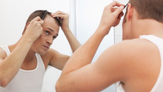 alopecia dos