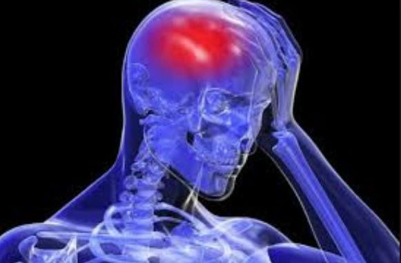 cerebrovasculares