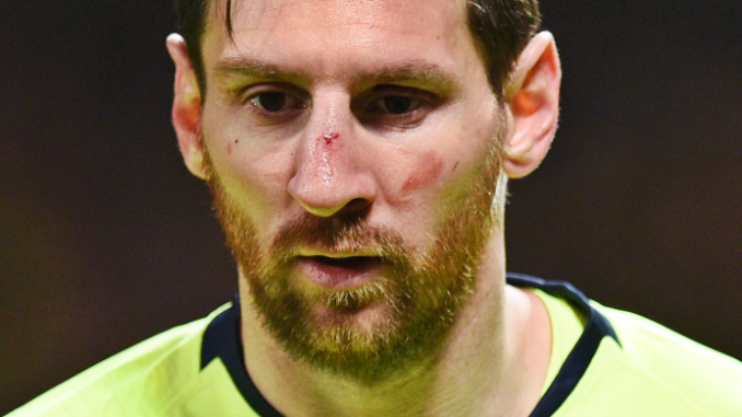 Messi golpeado