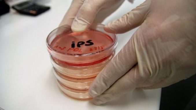celulas iPS