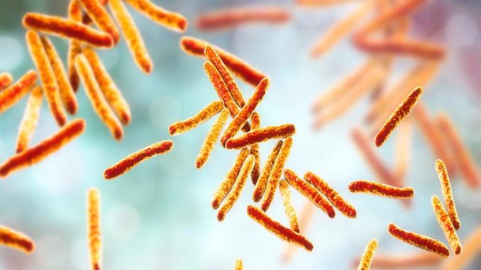 tuberculosis