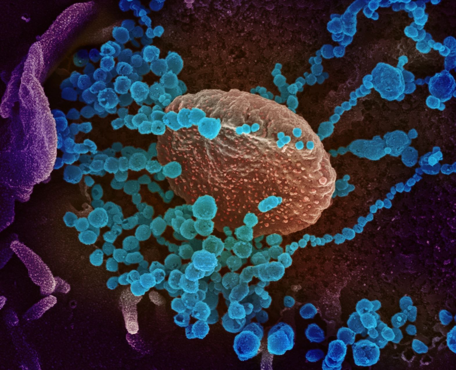 coronavirus eeuu