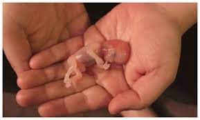 abortos