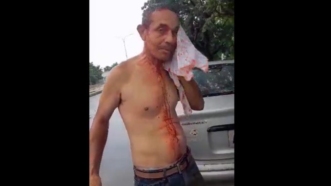 Heridos en Apure